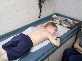 Mon 29 Nov 2010 03:14:02 PM

After having a 2nd astma attack this year, we had Andrew allergy tested.