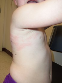 Mon 04 Feb 2013 11:45:53 AM

Allergy testing...