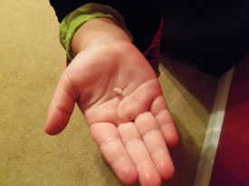 Sun 17 Aug 2014 08:24:09 PM

Gracie's first lost baby tooth. She pulled it herself! In fact, she pulled her first two teeth herself.